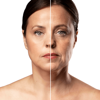 antes-despues-retrato-mujer-madura-retocada antes-despues-retrato-mujer-madura-retocada